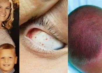 Alerta! Mãe revela que veias de seu filho explodiram ao girar rápido no balanço
