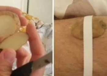 9 remédios estranhos que eram usados pelas vovós antigamente e que funcionavam muito