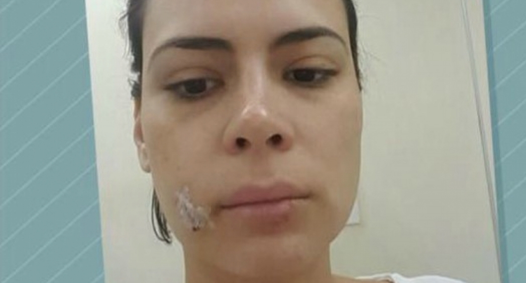 Apresentadora da Rede Globo leva 20 pontos no rosto após ser atacada por um cão