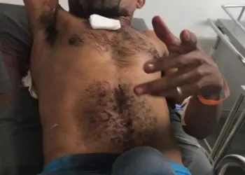 Homem é esfaqueado no peito pela esposa após se atrasar para almoço