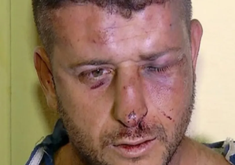 Mulher chega em casa bêbada e espanca marido por não querer ter relações com ela