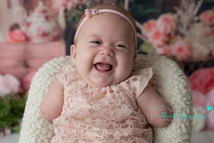 Médico sugere aborto de bebê sem braços e mãe dá resposta emocionante