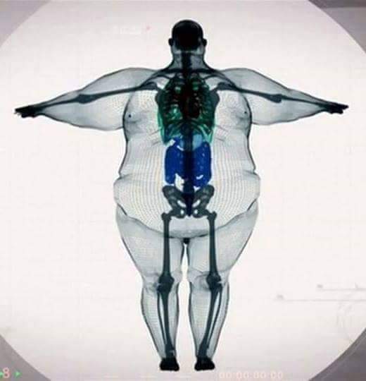 ENTENDA COMO LHE DAR COM A OBESIDADE