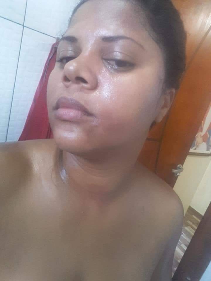 ALERTA!! ATENÇÃO MULHERES CUIDADO!!( FOTOS)