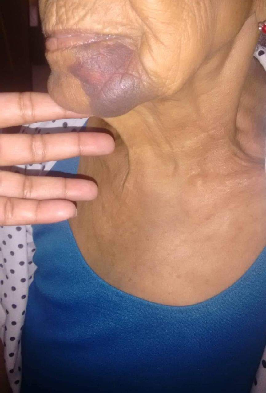 SENHORA DE 89 ANOS FOI ESTRANGULADA E TEVE CASA INVADIDA EM COMUNIDADE NA ZONA OESTE