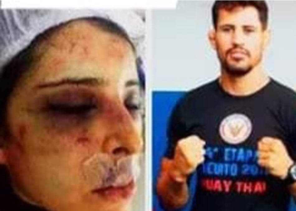 MÉDICA É AGREDIDA NO RJ POR NAMORADO PROFESSOR DE MUAY THAI