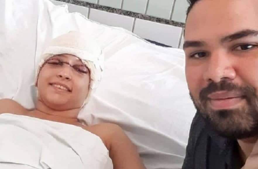 Namorado de jovem que teve couro cabeludo arrancado dá triste notícia