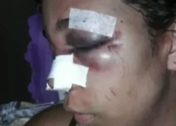 Mulher é espancada por ex-marido no RJ