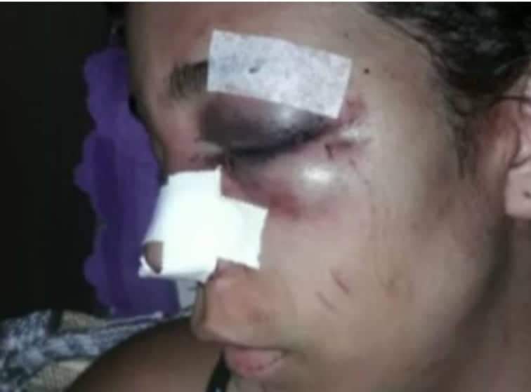 Mulher é espancada por ex-marido no RJ