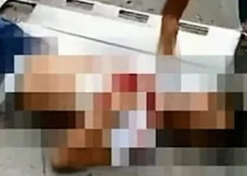 Mulher assassina namorado a tesouradas após ser chamada de gorda