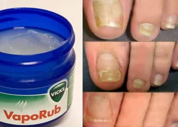 Tudo sobre os 10 usos incriveis do Vick Vaporub que você não sabia
