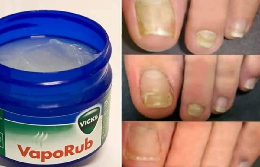 Tudo sobre os 10 usos incriveis do Vick Vaporub que você não sabia