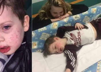 MENINO CONTRAI HERPES  COM BEIJO DE PARENTE!! ELE LUTA PELA VIDA