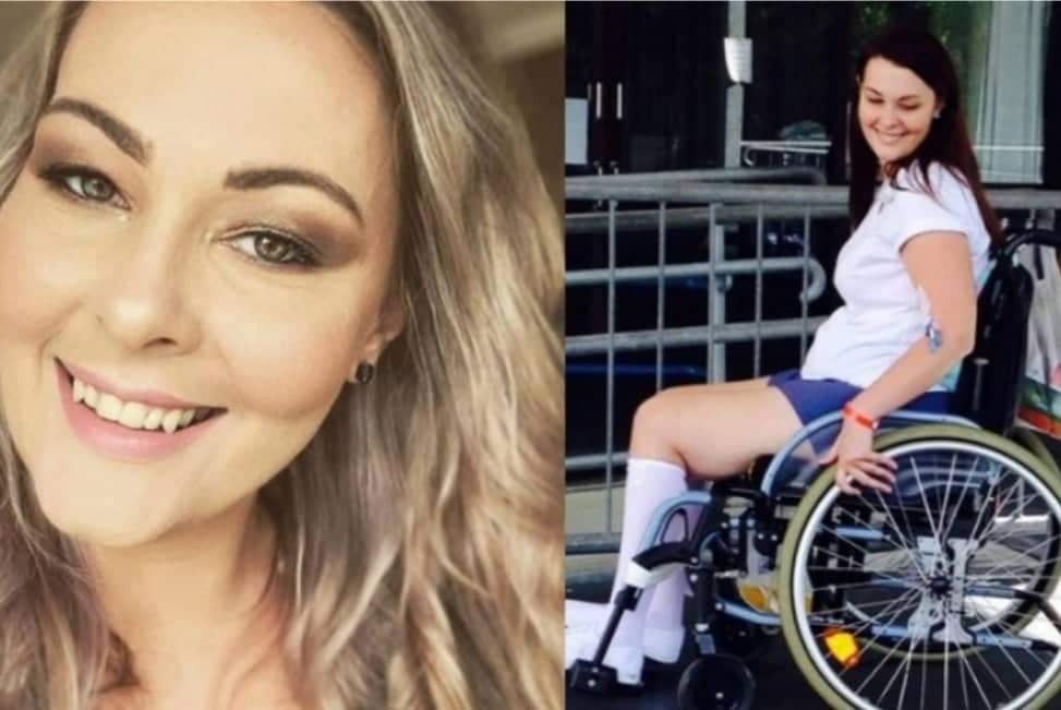 Mulher quase morre após usar pincel de maquiagem emprestado para cobrir espinha