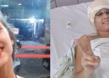 Saiba o que acontecerá com a jovem que teve couro cabeludo dilacerado no Kart
