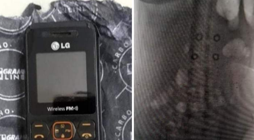 MULHER É FLAGRADA COM CELULAR NO ÂNUS TENTANDO ENTRAR EM PRESÍDIO NO RJ