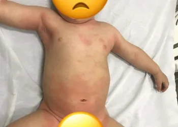 ATENÇÃO MAMÃES!! PASSEI UM SUFOCO COM MEU FILHO(FOTOS)