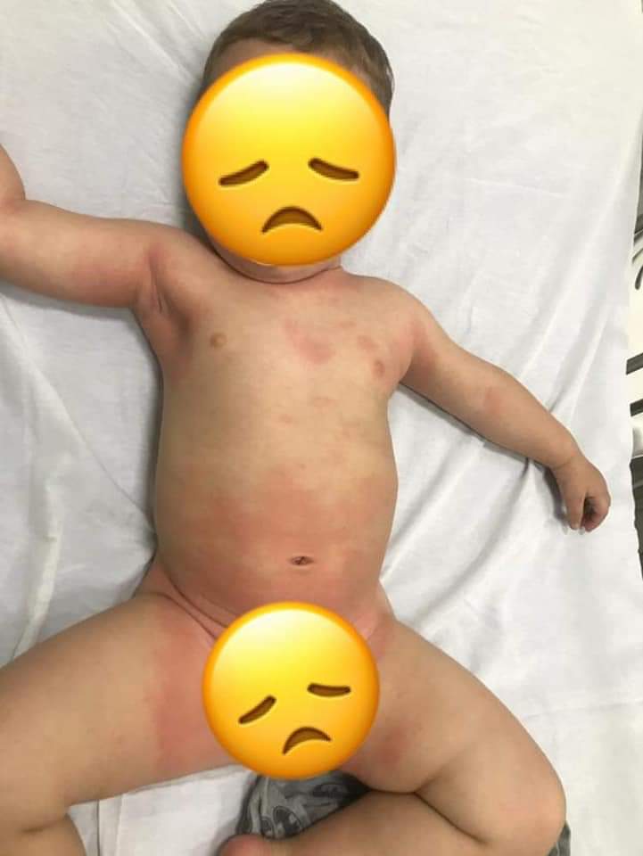 ATENÇÃO MAMÃES!! PASSEI UM SUFOCO COM MEU FILHO(FOTOS)