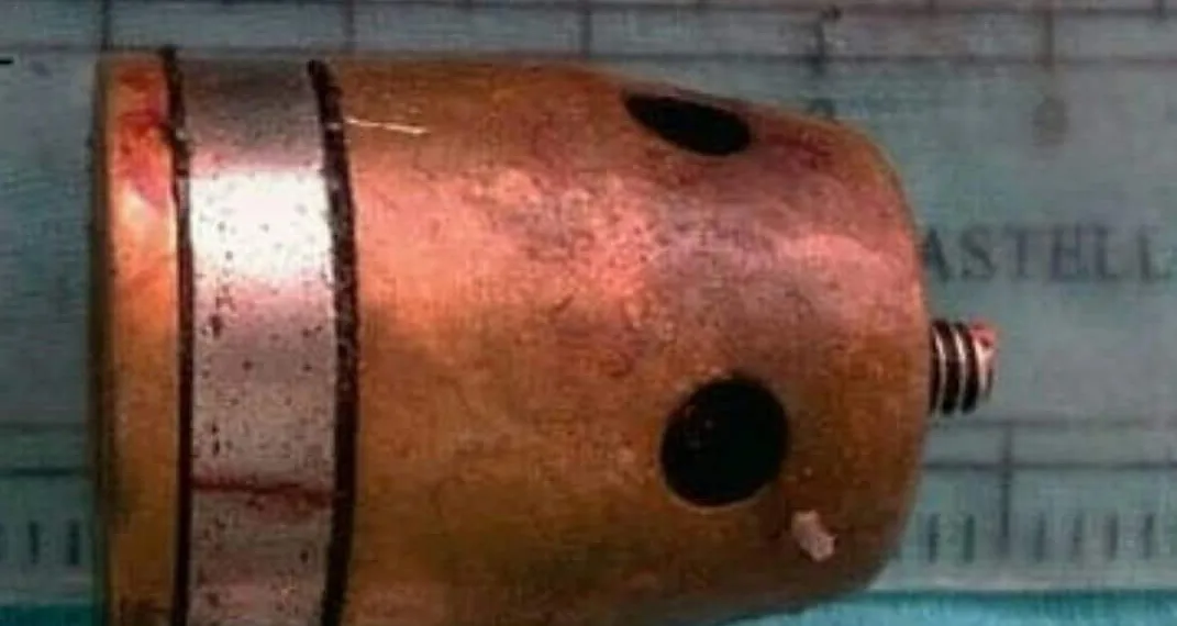 Regulador da panela de pressão bate em olho de cozinheira ( imagem forte)