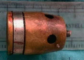 Regulador da panela de pressão bate em olho de cozinheira ( imagem forte)
