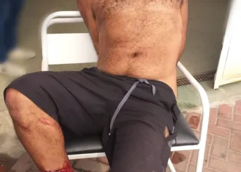 HOMEM QUE LIDERA QUADRILHA DE ROUBOS DE CARGA É BALEADO NA PERNA E PRESO EM ITAGUAÍ