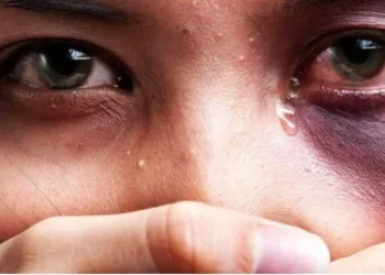 Mulher é estuprada por amigo durante festa de aniversário do próprio marido 