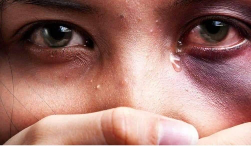 Mulher é estuprada por amigo durante festa de aniversário do próprio marido 