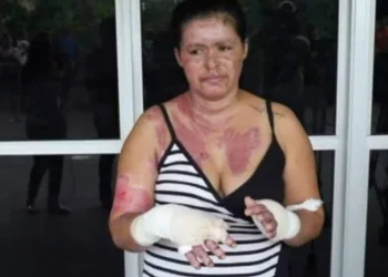 MANICURE ATENDE LIGAÇÃO DE CELULAR PRÓXIMO AO MICRO-ONDAS E ELE EXPLODE