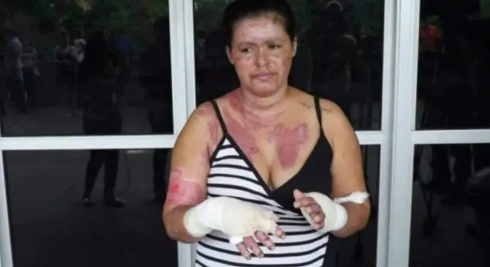 MANICURE ATENDE LIGAÇÃO DE CELULAR PRÓXIMO AO MICRO-ONDAS E ELE EXPLODE