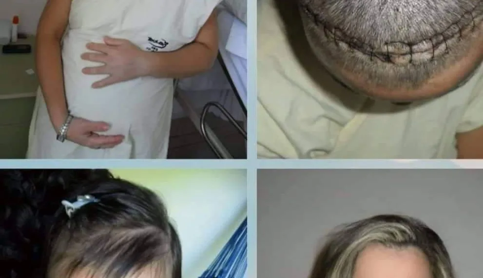 Exemplo de superação ❤😊👐