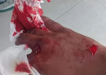 BRIGA DE JOVENS CAUSAM MEDO E PAVOR EM SANTA CRUZ( FOTOS)