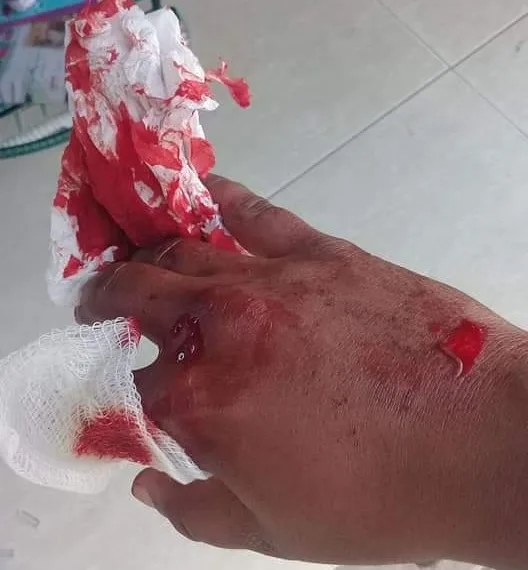 BRIGA DE JOVENS CAUSAM MEDO E PAVOR EM SANTA CRUZ( FOTOS)