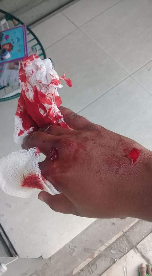 BRIGA DE JOVENS CAUSAM MEDO E PAVOR EM SANTA CRUZ( FOTOS)