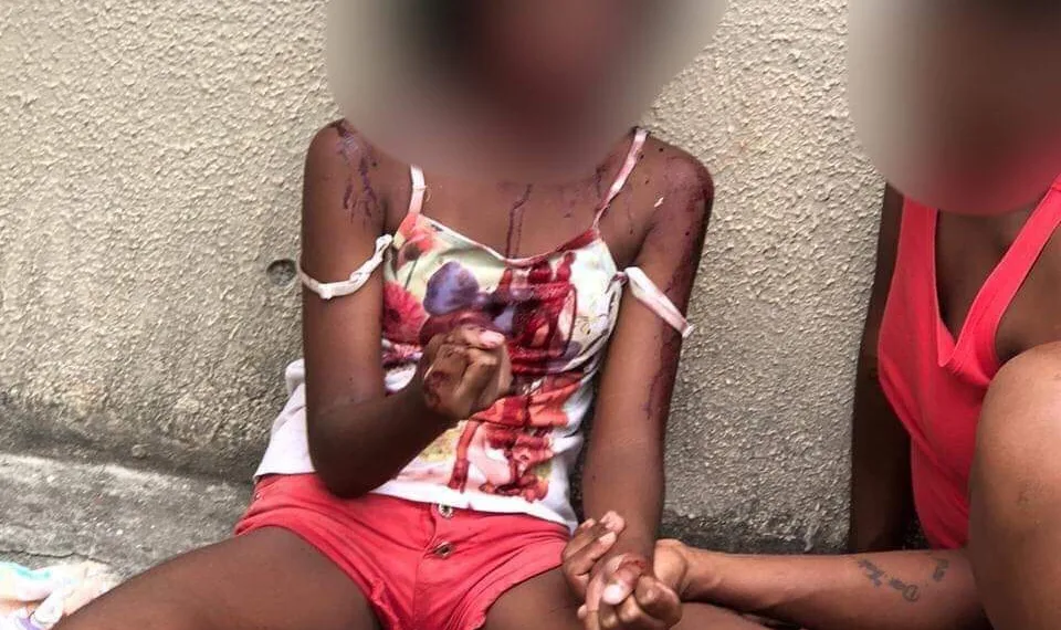 PADRASTO ESPANCA ENTEADA EM PALMARES