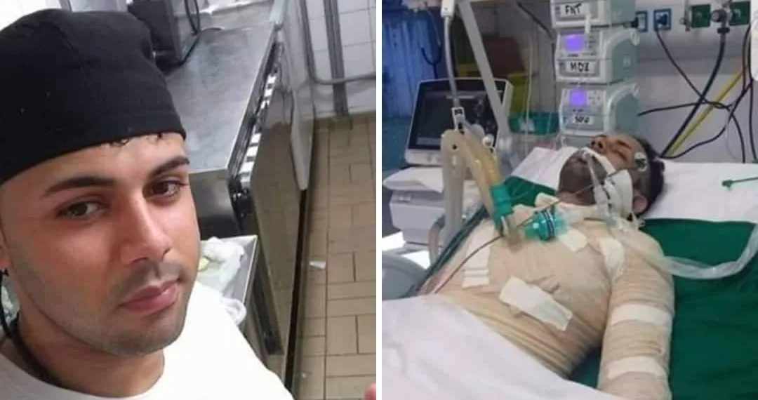 MULHER ATEOU FOGO NO EX NAMORADO NO RJ!! SEU ESTADO É GRAVE