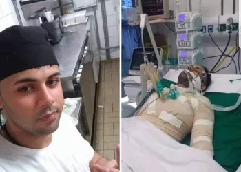 MULHER ATEOU FOGO NO EX NAMORADO NO RJ!! SEU ESTADO É GRAVE