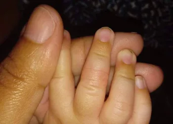 Um dos dias mais desesperadores da minha vida e do meu bebê