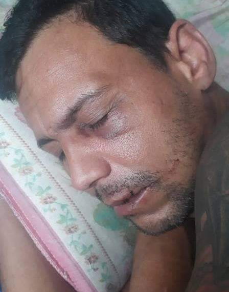 HOMEM ESPANCADO NO ENGENHÃO NA TORCIDA DO BOTAFOGO É TORCEDOR DO BOTAFOGO
