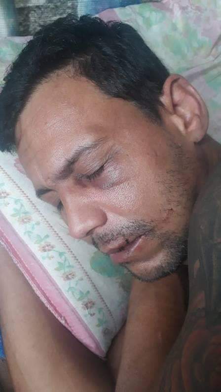 HOMEM ESPANCADO NO ENGENHÃO NA TORCIDA DO BOTAFOGO É TORCEDOR DO BOTAFOGO