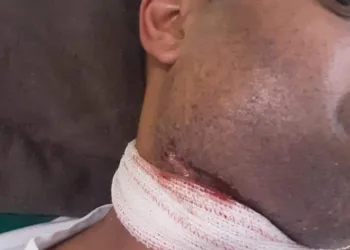 O QUE UMA DOR DE DENTE PODE CAUSAR… CUIDADO!!