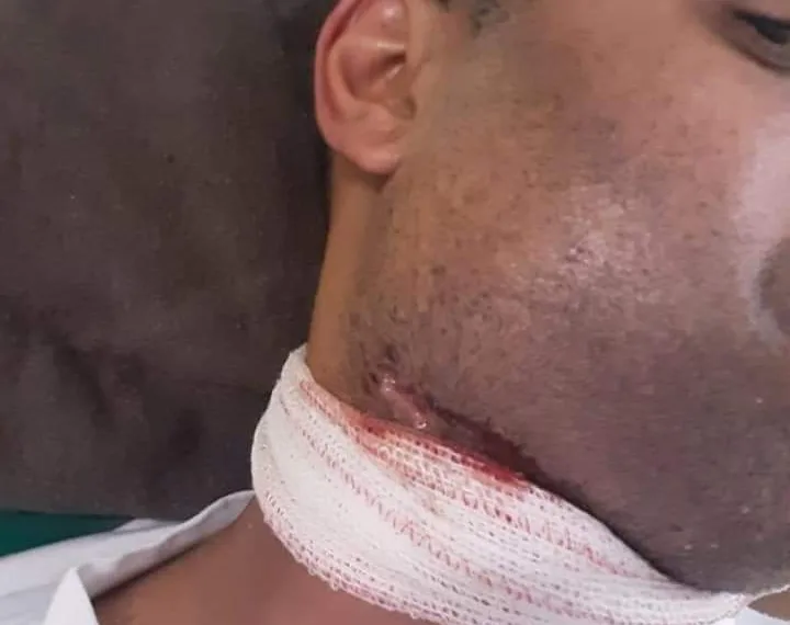 O QUE UMA DOR DE DENTE PODE CAUSAR… CUIDADO!!