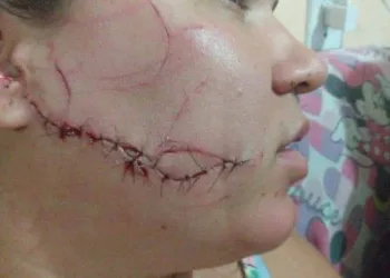 MULHER É AGREDIDA COVARDEMENTE EM CAMPO GRANDE