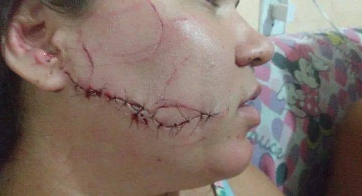 MULHER É AGREDIDA COVARDEMENTE EM CAMPO GRANDE