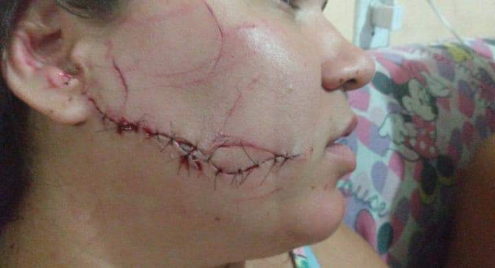 MULHER É AGREDIDA COVARDEMENTE EM CAMPO GRANDE