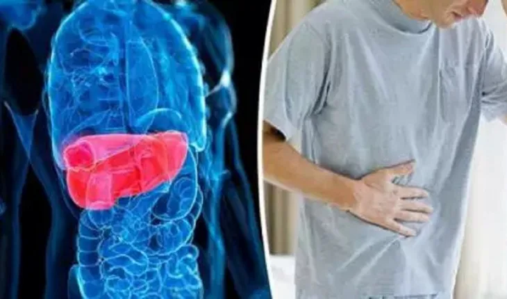 8 sinais que podem indicar câncer no fígado; doença é altamente letal e silenciosa