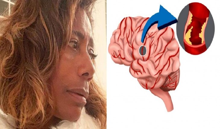 Lesão cerebral de Glória Maria pode ser maligna e Brasil ora