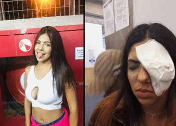 Operação da PM em baile funk deixa jovem cega com bala de borracha