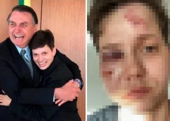 Fotos: Karol Eller, homossexual amiga da família Bolsonaro, é brutalmente espancada no Rio