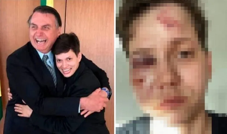 Fotos: Karol Eller, homossexual amiga da família Bolsonaro, é brutalmente espancada no Rio