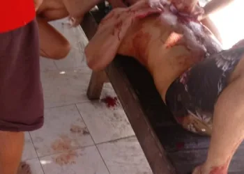 Pai esfaqueado após defender a filha passou por cirurgia e está em estado estável no RJ